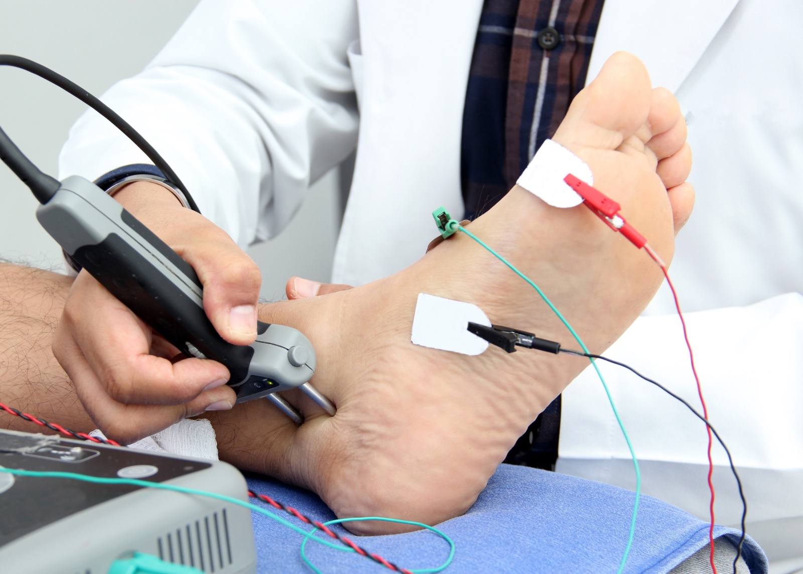 Somatosensory Evoked Potentials (SEP) or Nerve Conduction Velocity (NCV) is a test of electrical signals through a nerve