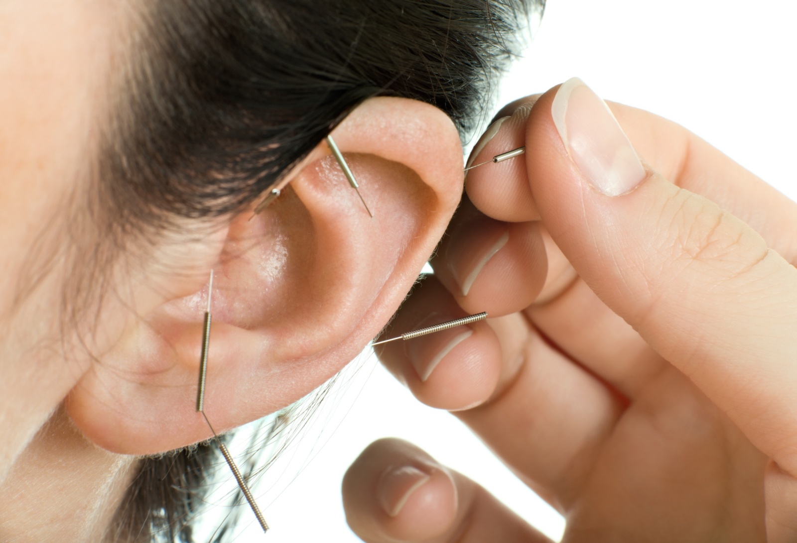 acupuncture therapy on ear, close up photo